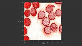 赤血球の表面形状
